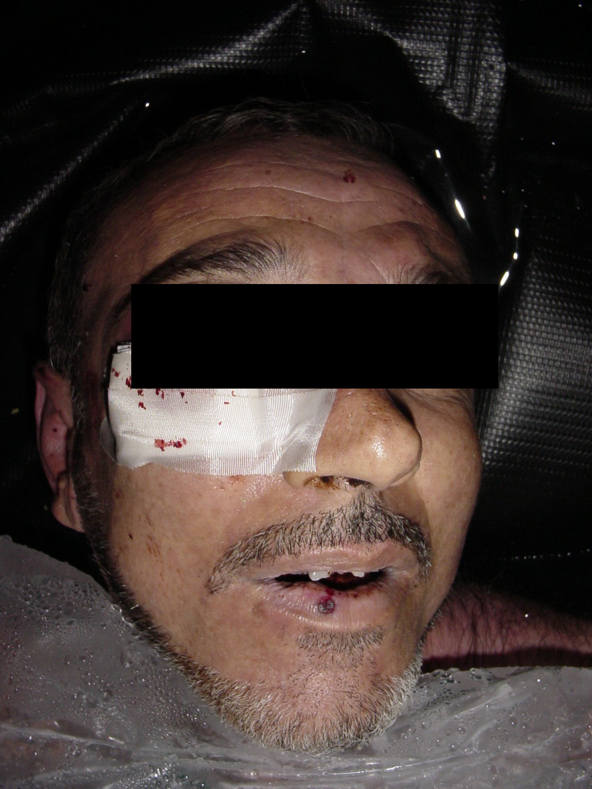 Photo of tortured prisoner from Abu Gharib prison in Iraq.