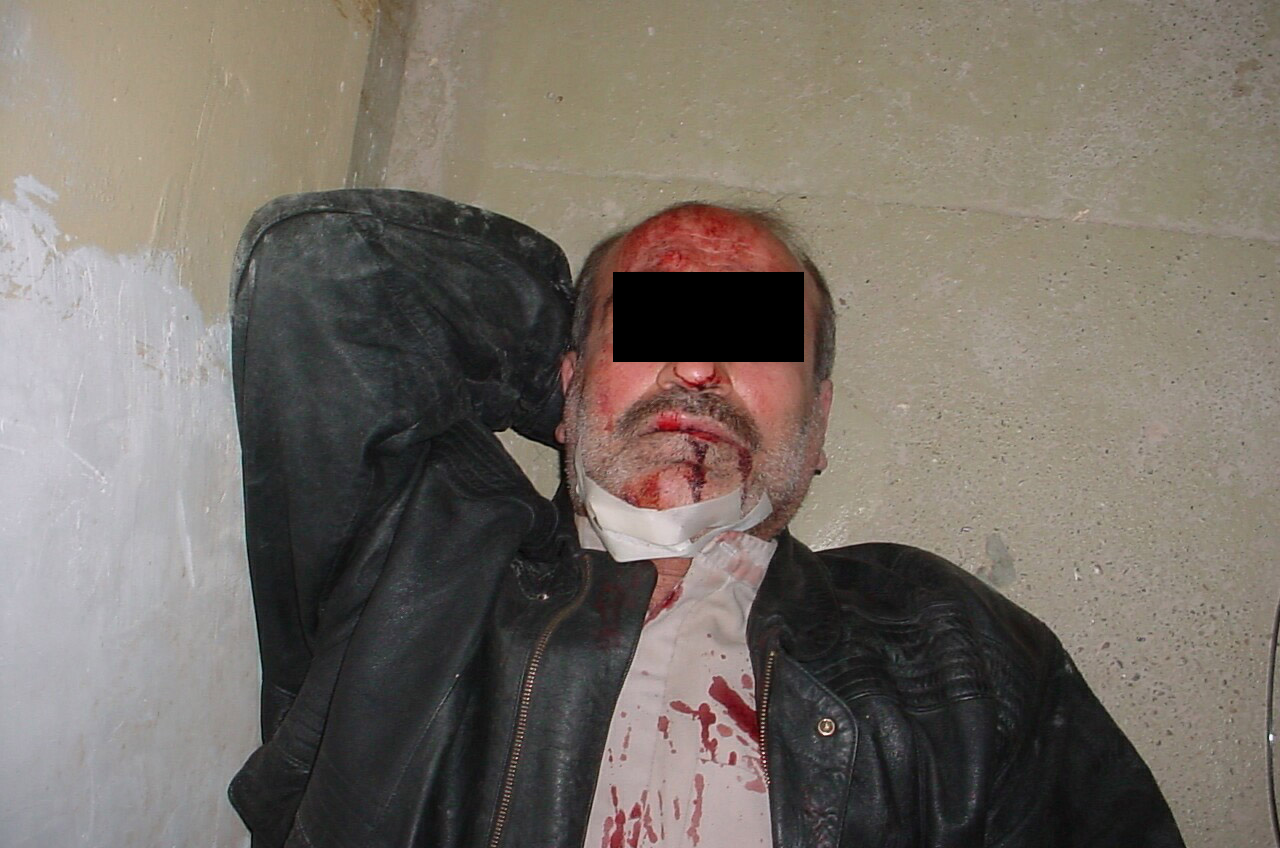 U.S. abuses prisoners at Abu Gharib