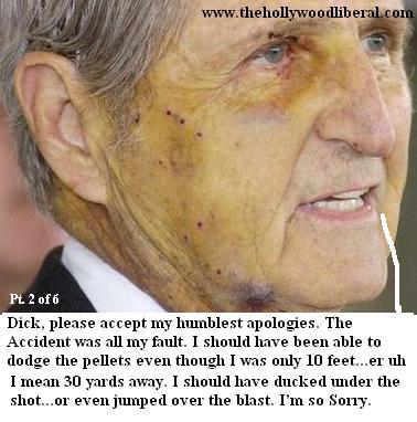 Close up of Harry Whittington's face, after getting shot by Dick Cheney